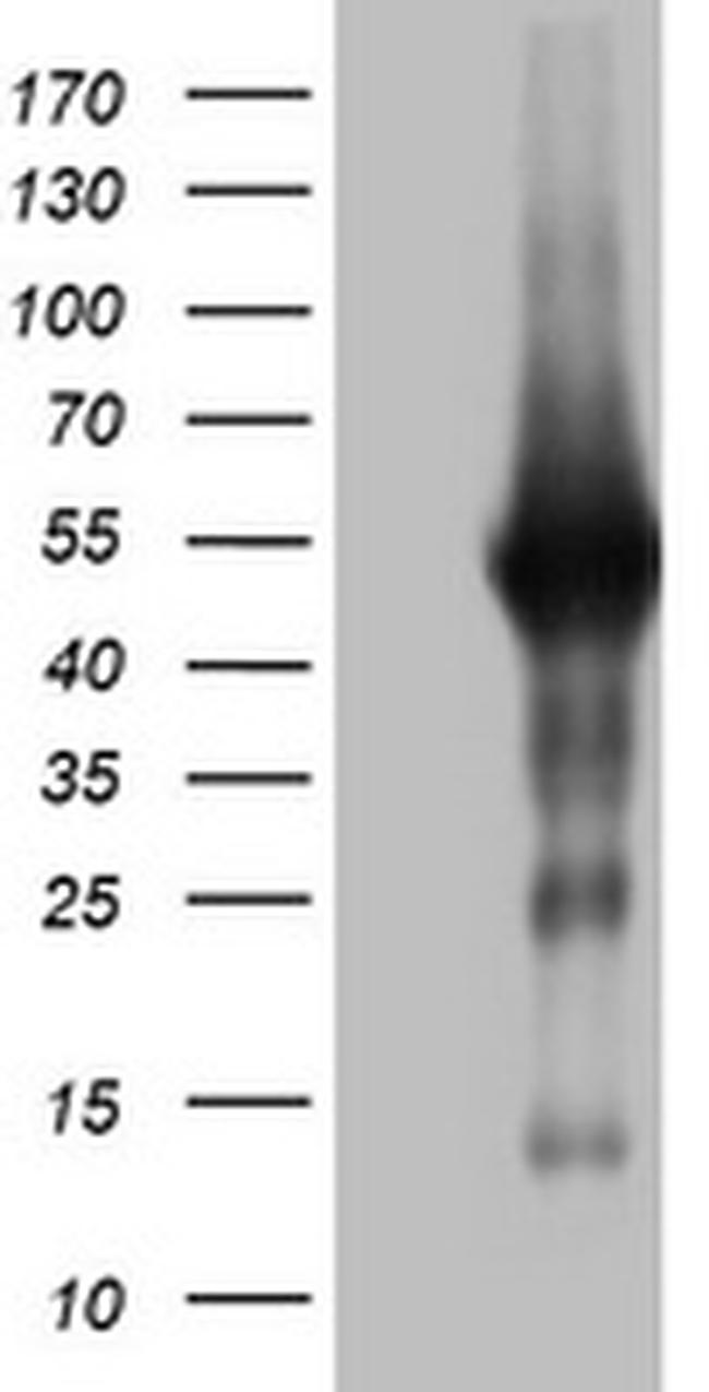 SPATA2L Antibody in Western Blot (WB)