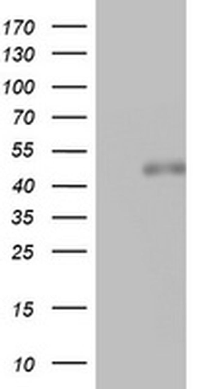 SPATA2L Antibody in Western Blot (WB)