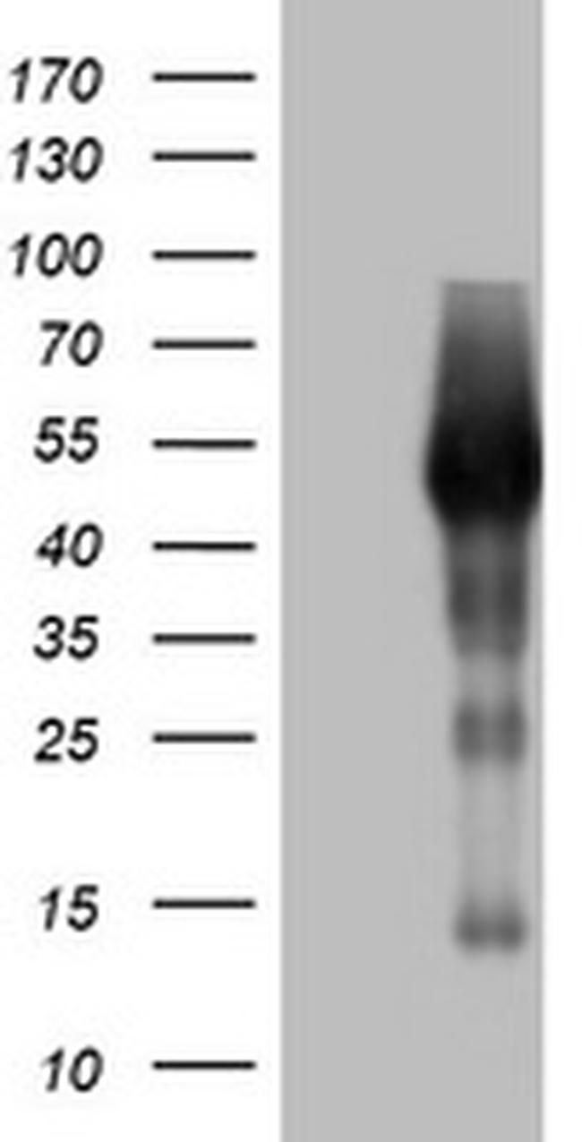 SPATA2L Antibody in Western Blot (WB)