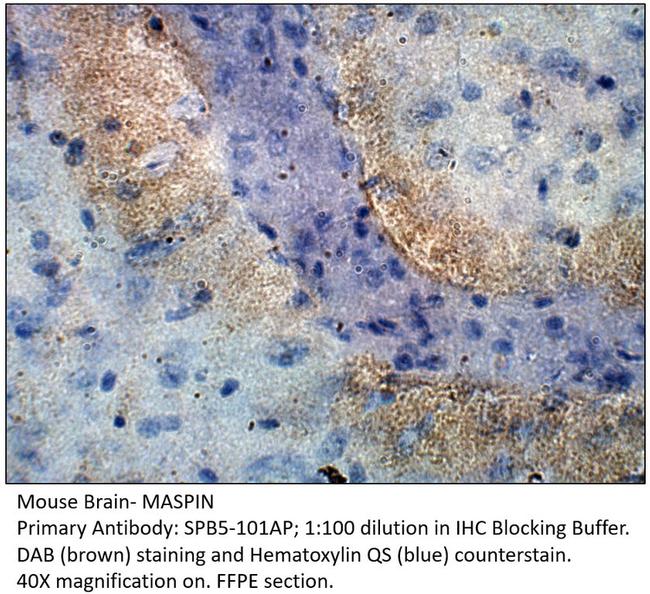 MASPIN Antibody in Immunohistochemistry (Paraffin) (IHC (P))