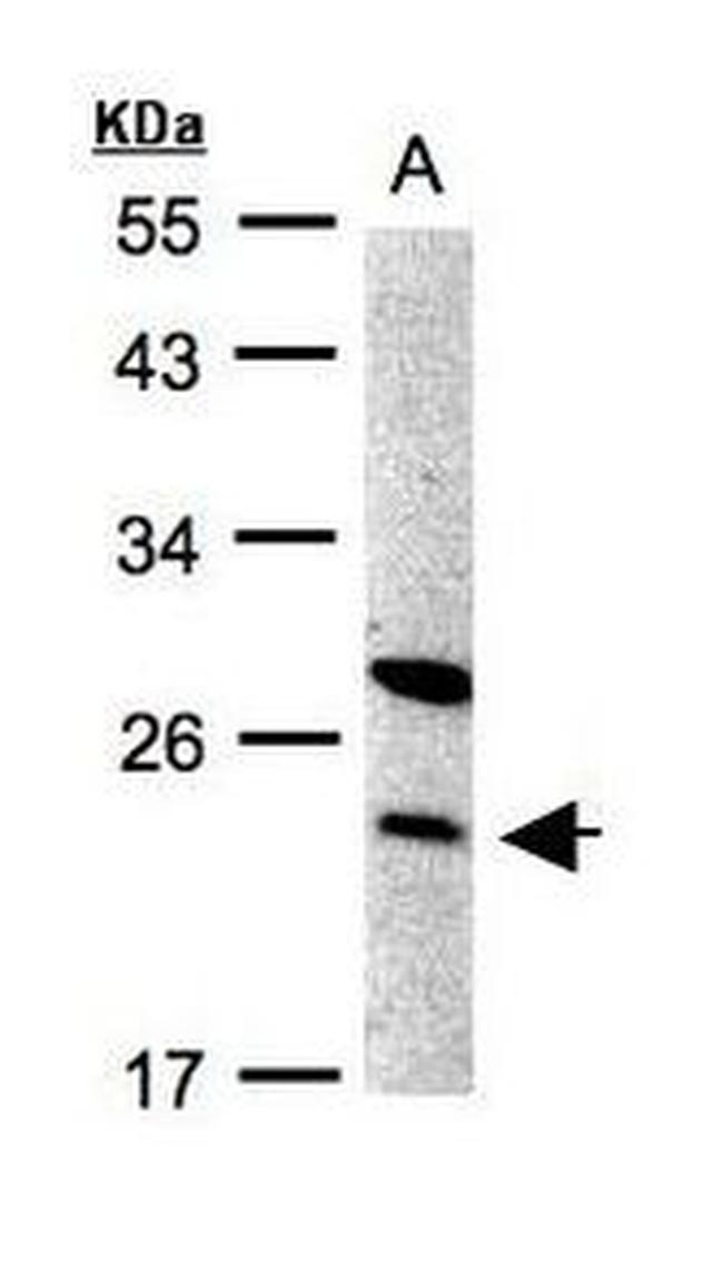 SPC24 Antibody in Western Blot (WB)