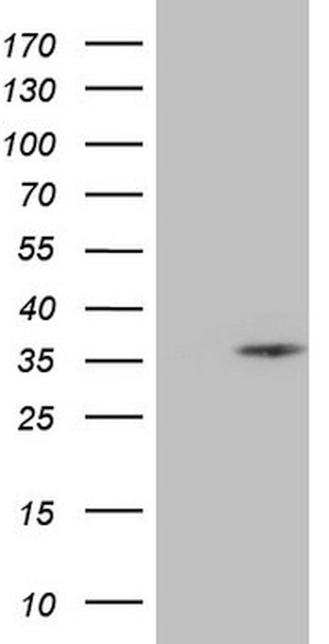 SPC25 Antibody in Western Blot (WB)
