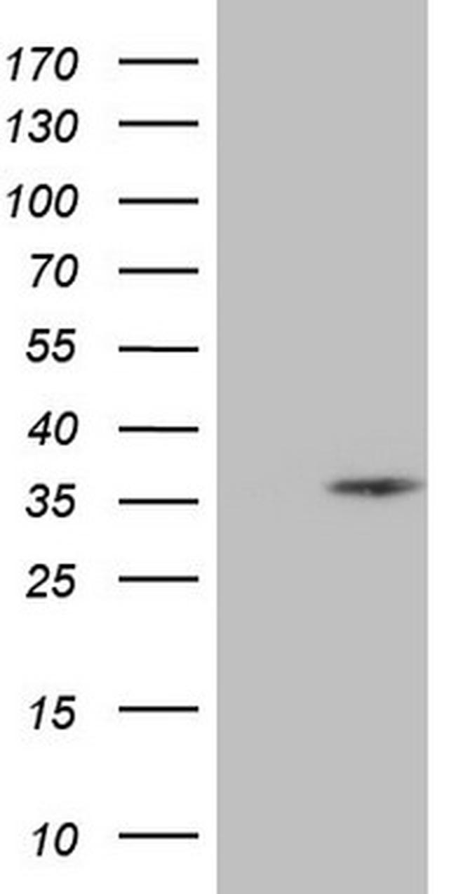 SPC25 Antibody in Western Blot (WB)