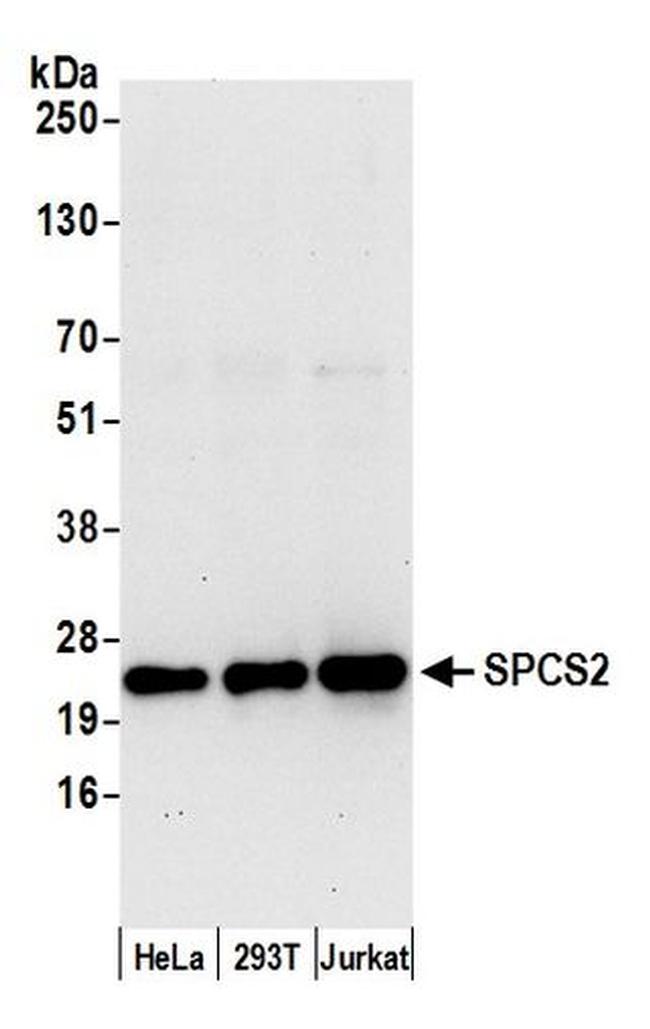 SPCS2 Antibody in Western Blot (WB)