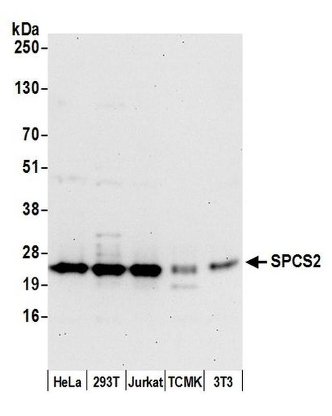 SPCS2 Antibody in Western Blot (WB)