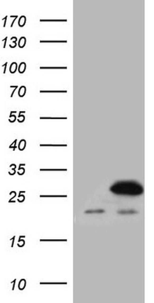 SPCS2 Antibody in Western Blot (WB)