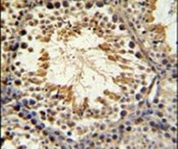 SPAG16 Antibody in Immunohistochemistry (IHC)