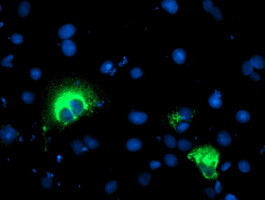SPG7 Antibody in Immunocytochemistry (ICC/IF)