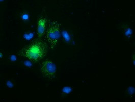 SPG7 Antibody in Immunocytochemistry (ICC/IF)