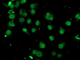 SPG7 Antibody in Immunocytochemistry (ICC/IF)