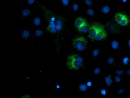 SPG7 Antibody in Immunocytochemistry (ICC/IF)