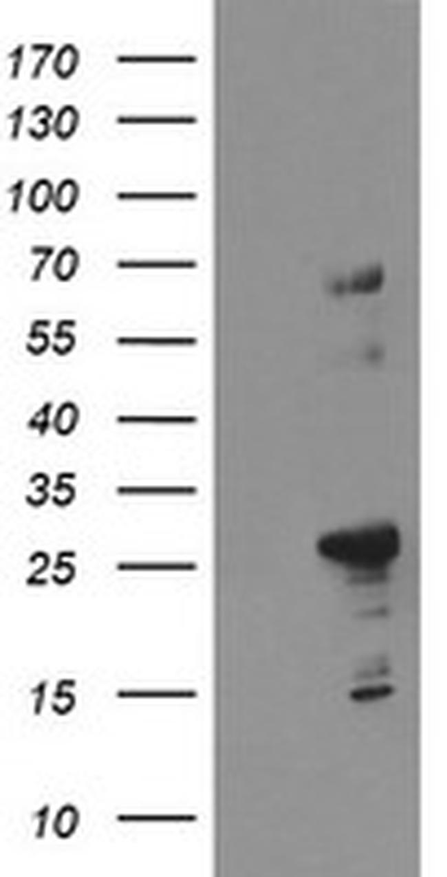 SPG7 Antibody in Western Blot (WB)