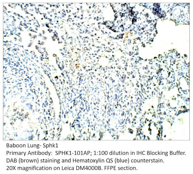 SPHK1 Antibody in Immunohistochemistry (IHC)