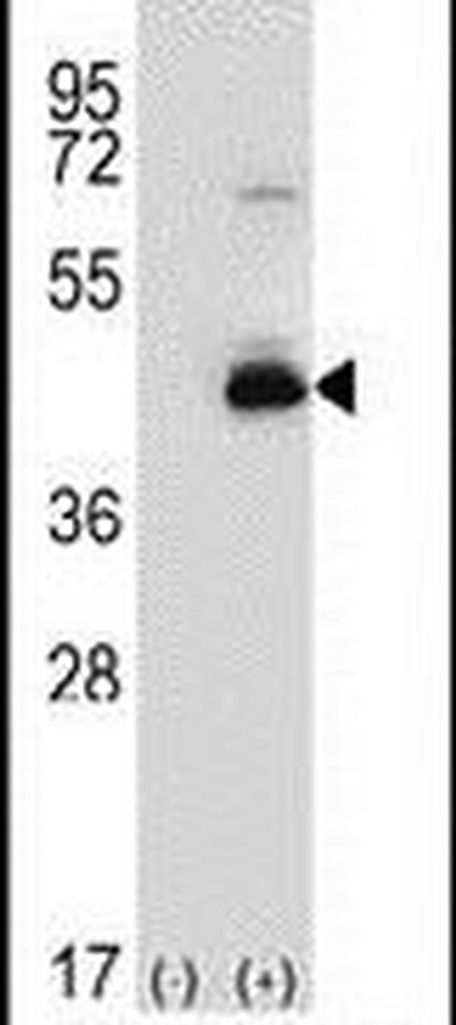 SPHK1 Antibody in Western Blot (WB)