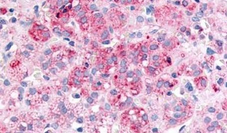 SPHK1 Antibody in Immunohistochemistry (Paraffin) (IHC (P))