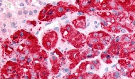 SPHK1 Antibody in Immunohistochemistry (Paraffin) (IHC (P))