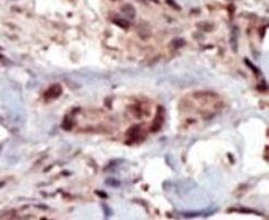 SPHK2 Antibody in Immunohistochemistry (IHC)