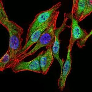 SPIB Antibody in Immunocytochemistry (ICC/IF)