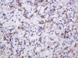 SPN Antibody in Immunohistochemistry (Paraffin) (IHC (P))