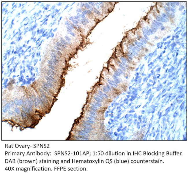 SPNS2 Antibody in Immunohistochemistry (IHC)