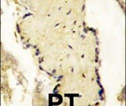 SPPL2A Antibody in Immunohistochemistry (IHC)