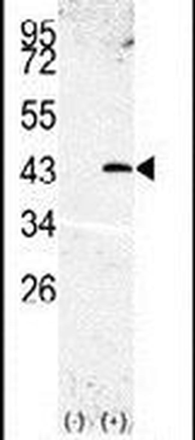 SPPL3 Antibody in Western Blot (WB)
