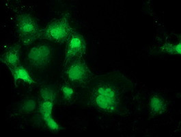 SPR Antibody in Immunocytochemistry (ICC/IF)