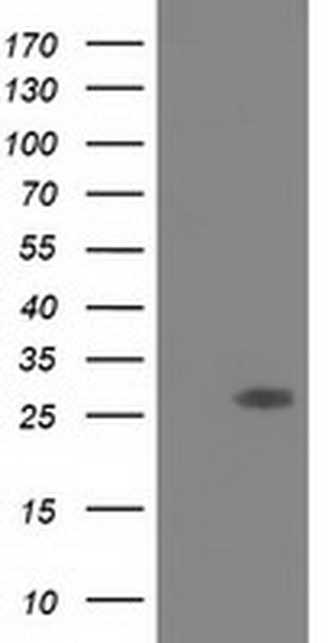 SPR Antibody in Western Blot (WB)