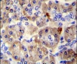 SPRED3 Antibody in Immunohistochemistry (IHC)
