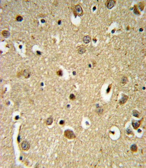 SPRY4 Antibody in Immunohistochemistry (IHC)