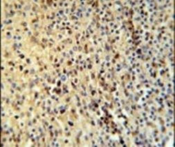 SPATA13 Antibody in Immunohistochemistry (IHC)