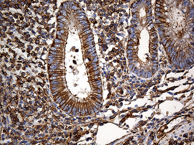 SPTAN1 Antibody in Immunohistochemistry (Paraffin) (IHC (P))
