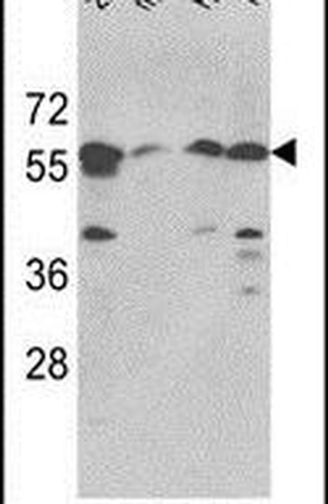 SPTLC1 Antibody in Western Blot (WB)