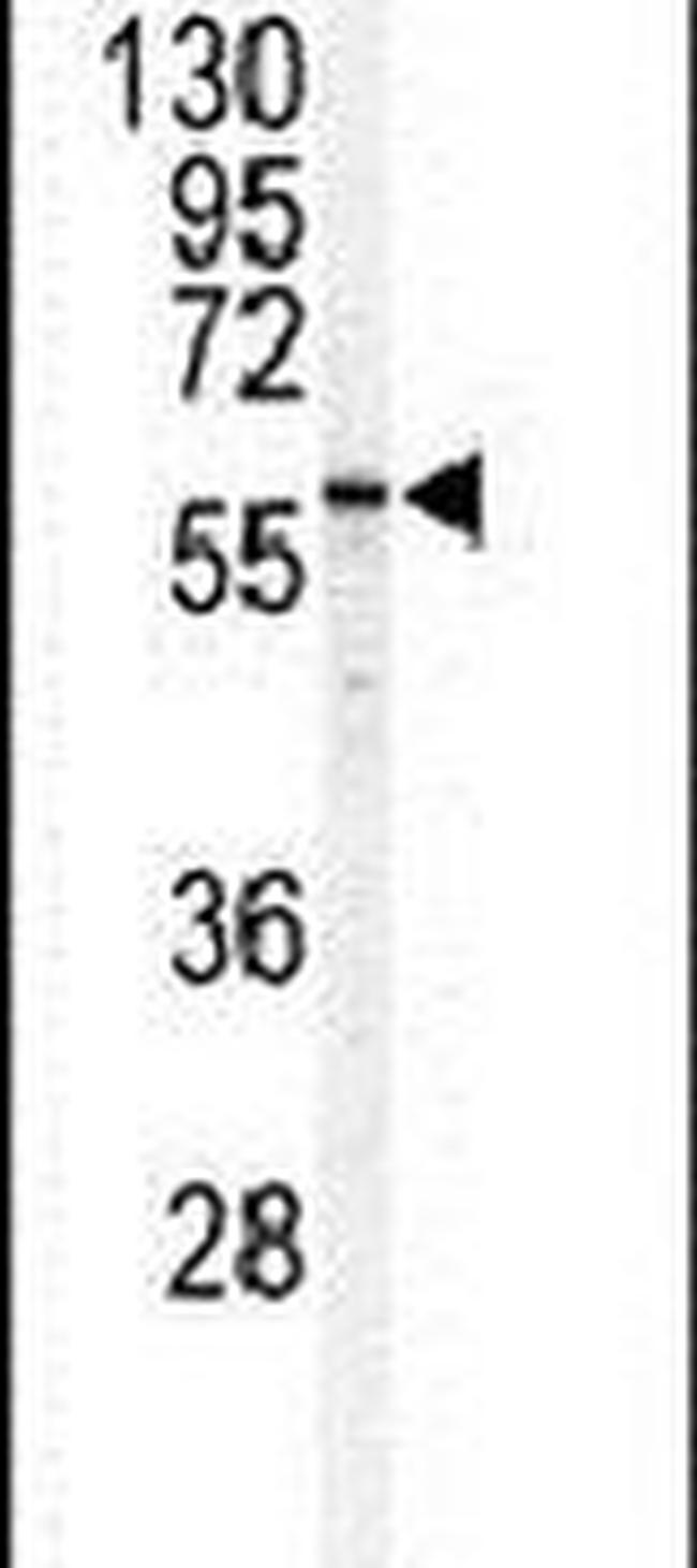 SPTLC1 Antibody in Western Blot (WB)