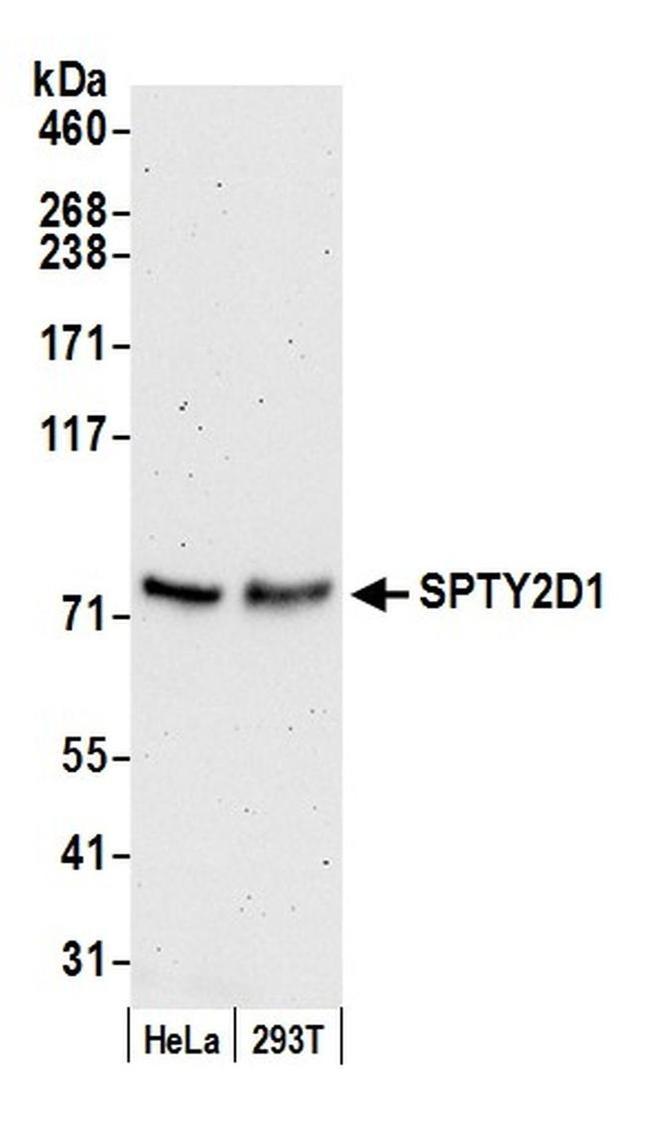 SPTY2D1 Antibody in Western Blot (WB)