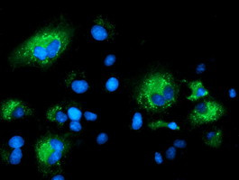 SQSTM1 Antibody in Immunocytochemistry (ICC/IF)