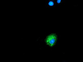 SQSTM1 Antibody in Immunocytochemistry (ICC/IF)