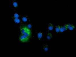 SQSTM1 Antibody in Immunocytochemistry (ICC/IF)