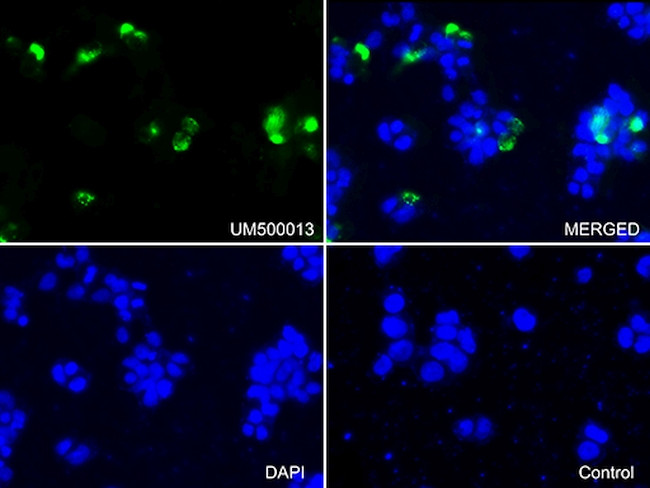 SQSTM1 Antibody in Immunocytochemistry (ICC/IF)