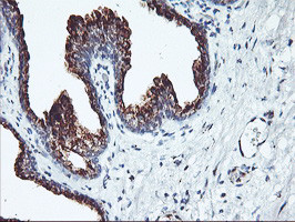SQSTM1 Antibody in Immunohistochemistry (Paraffin) (IHC (P))