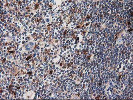 SQSTM1 Antibody in Immunohistochemistry (Paraffin) (IHC (P))