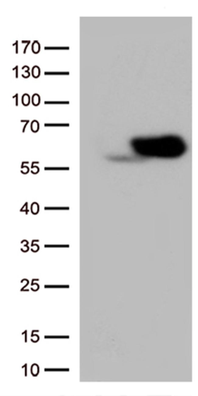 SQSTM1 Antibody in Western Blot (WB)