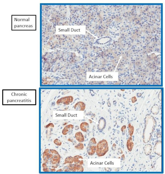 SR140 Antibody in Immunohistochemistry (IHC)