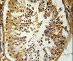 SERAC1 Antibody in Immunohistochemistry (IHC)