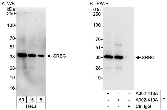 SRBC Antibody in Western Blot (WB)