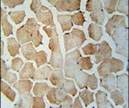 SRBD1 Antibody in Immunohistochemistry (IHC)