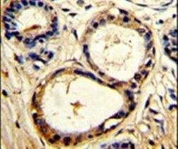 Cortactin Antibody in Immunohistochemistry (IHC)