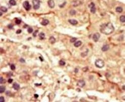 SRMS Antibody in Immunohistochemistry (IHC)
