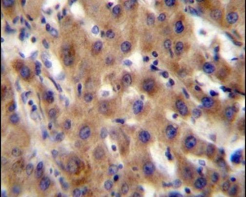 SRPK1 Antibody in Immunohistochemistry (IHC)