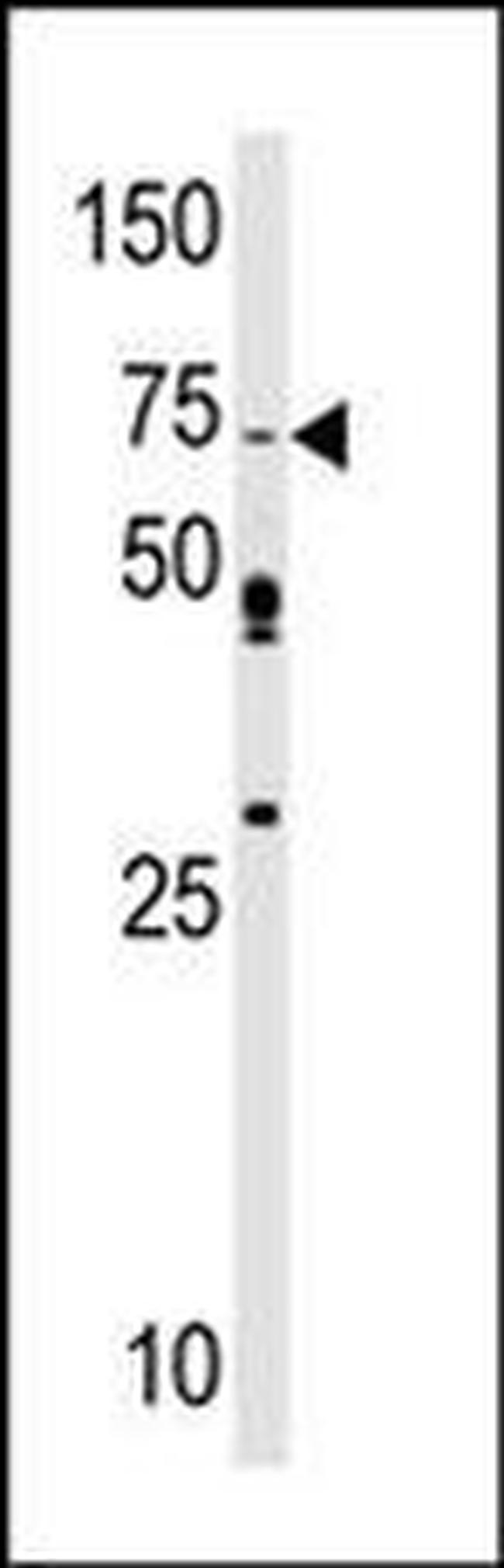SRPK1 Antibody in Western Blot (WB)
